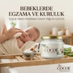 Bebeklerde Egzama ve Kuruluk: Soğuk Sıkım Hindistan Cevizi Yağı ile Çözüm bebeklerde egzama ve kuruluk